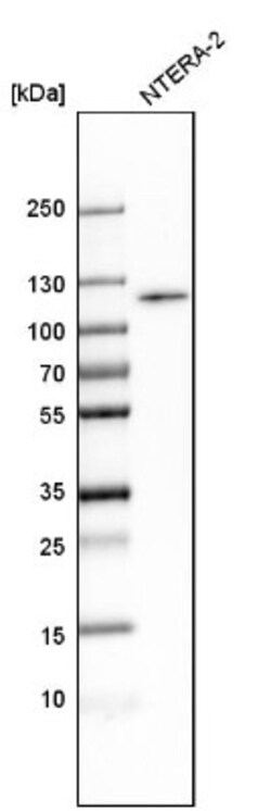 BICD1 Antibody, Novus Biologicals:Antibodies:Primary Antibodies